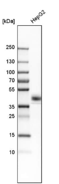 CXADR Antibody, Novus Biologicals 25 &mu;L; Unlabeled:Antibodies, Polyclonal